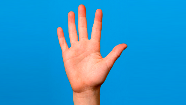 5 things to know if you are injured in a motor vehicle accident